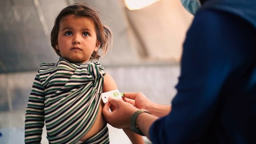 A doctor examines children's malnutrition inside a refugee camp. Malnutrition was measured using a