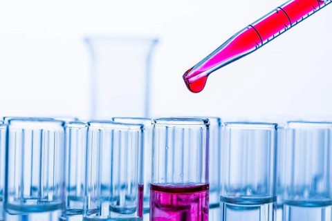 Many test tubes during an experiment in a university research laboratory. Blood, blood test,
