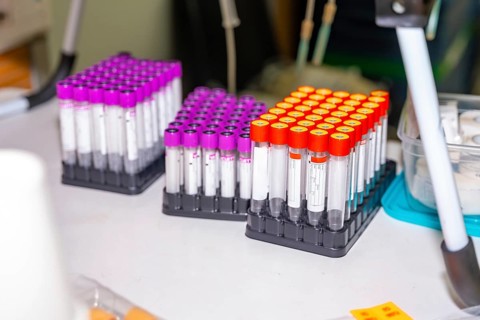 Samples of blood labeled on a table with no people