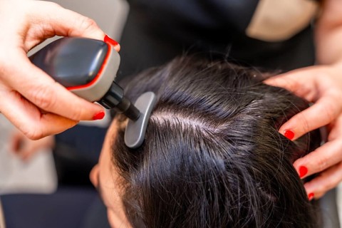 Top view close-up of a woman receiving modern treatment to combat hair loss using Indiba machine