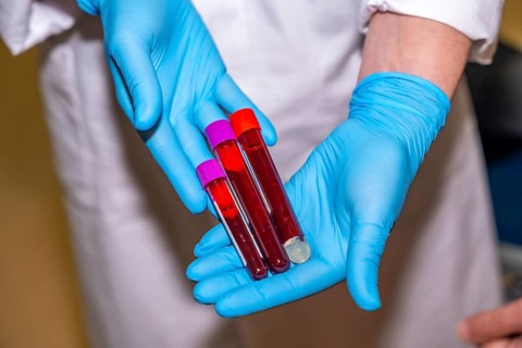Close-up top view of a doctor showing tubes of blood samples in a donation center