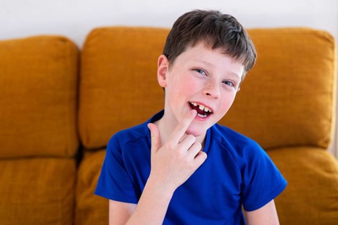 A cheerful young boy sits on a couch, wearing a blue shirt and pointing to his missing milk tooth