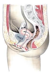 Anatomy, human, schematic representation of female genitals, reproduction of a historical school