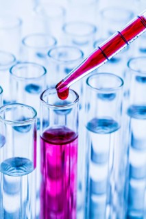 Many test tubes during an experiment in a university research laboratory. Blood, blood test,