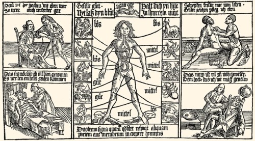 Medicine treatment, bloodletting procedure, woodcut, 1480, Medizinische Behandlung, Aderlass