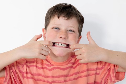 A cheerful young boy in a striped orange t-shirt proudly displays his milk teeth, stretching his