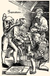 German surgeon, amputation of leg without anaesthetic, Hans van Gersdorff, 1528, 'Feldtbuch der