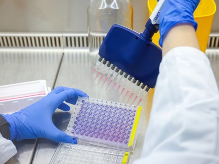 Bonn, North Rhine-Westphalia, Germany - Research in the field of immunology and infectology at the
