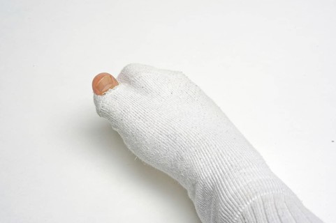 Bandaged foot, inflammation, broken, broken, after surgery