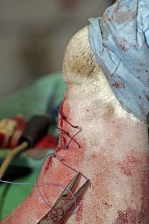 Removal of a skin tumour in a dog, skin tumour, vet, wound is sutured