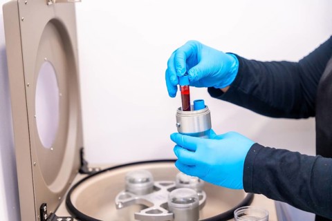 Technician in blue gloves preparing test tubes for analysis in a beauty clinic for baldness