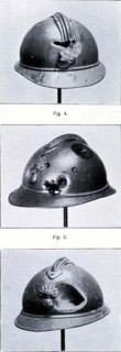 Trois casques ayant sauvé la vie de soldats lors de la 1ère Guerre mondiale