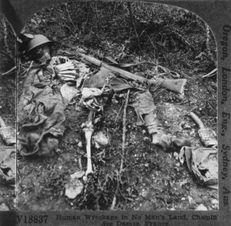 Human Skeleton Remains of Soldier, World War I, Chenin des Dames, France