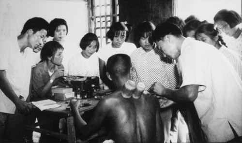 Doctor Performing Acupuncture and Utilizing Bamboo Suction Tubes while Students Watch, Malu People's Commune, Shanghai, China, 1965