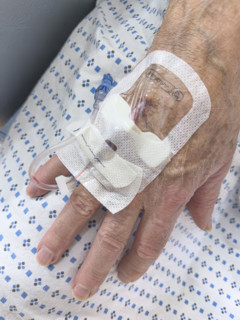 Hospital patient with IV port inserted in his hand