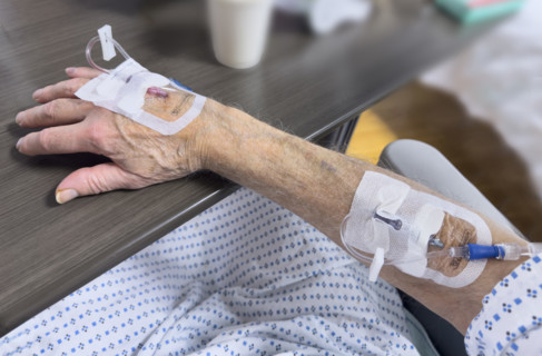 Hospital patient with IV ports inserted in his hand and forearm