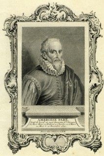 Ambroise Paré