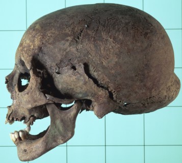 Stages in facial reconstruction of the bathrocranic skull. Artist: Unknown