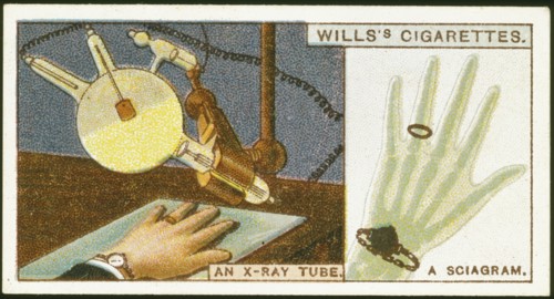 X-raying the hand, 1924. Artist: Unknown