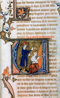 Cupping, 14th century. Artist: Unknown