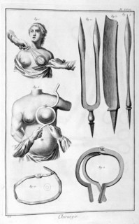 Breast surgery, 1751-1777. Artist: Unknown