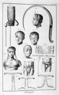 Surgery, 1751-1777. Artist: Unknown