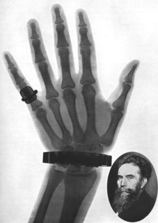 X-ray photograph of a hand, 1926. Artist: Unknown
