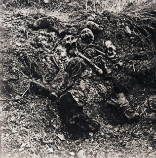 Human remains, c1914-c1918. Artist: Unknown.