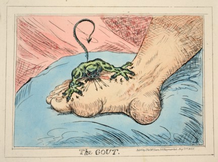 The Gout, 1835.
