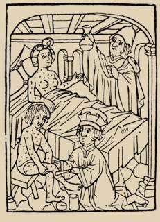 Syphilis treatment: Treatment with ointments (mercury). From: A Malafranczos morbo gallorum preserv