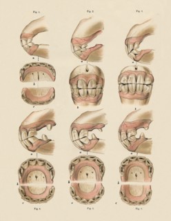 Description of Plate Showing the Age, As Indicated By The Teeth', c1879.