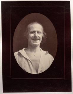 Figure 32: Rire naturel par la contraction volontaire des deux grands zygomatiques..., c. 1856. Creator: Guillaume-Benjamin-Amand Duchenne (de Boulogne) (French, 1806-1875); Adrien Tournachon (French,...