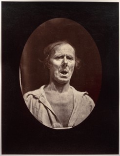 Figure 54: Abaissement volontaire de la mâchoire inférieure: mouvement inexpressif, c. 1856. Creator: Guillaume-Benjamin-Amand Duchenne (de Boulogne) (French, 1806-1875); Adrien Tournachon (French, 18...