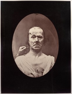 Figure 7: Étude du méchanisme et de lexpression du muscle frontal chez un vieillard: à droit..., c.  Creator: Guillaume-Benjamin-Amand Duchenne (de Boulogne) (French, 1806-1875); Adrien Tournachon (Fr...