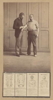 Notation of Scars, Schematic Drawings, ca. 1893.