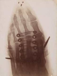 Le pied à travers la chaussure, 1896.