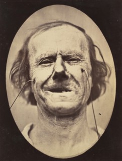 Figure 48: Mild weeping, pity and feeble false laughter , 1854-56, printed 1862.