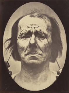 Figure 20: Profound suffering, with resignation, 1854-56, printed 1862.