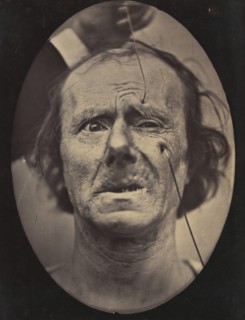 Figure 49: Painful weeping and forward looking., 1854-56, printed 1862.