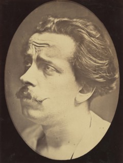 Figure 25: Not an expression of pain, 1854-56, printed 1862.