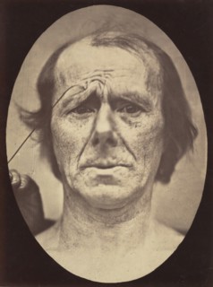 Figure 19: Suffering , 1854-56, printed 1862.