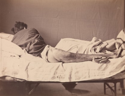 Private George Ruoss, Co. G, 7th New York Volunteers, 1865-1866.
