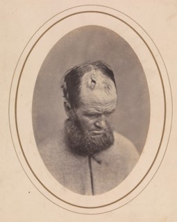 Private John Parkhurst, Company E, Second New York Heavy Artillery, 1865.