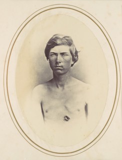 Frederick A. Bentley, 1865.