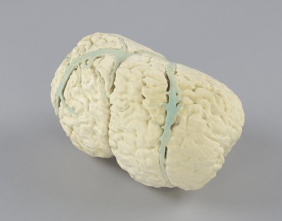Model of the conjoined brains of Ladan and Laleh Bijani used by Dr. Ben Carson, 2003. Creator: Unknown.