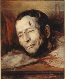 Head of Giuseppe Fieschi (1790-1836), after his execution, 1836.