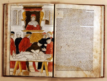 Coloured xilograph that shows for the first time the operation of a corpse dissection, 1493-1494. Creator: Johan Ketham (1415-1470).