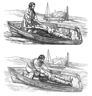 Restorative treatment of the apparently drowned:...Silvester's method of inducing respiration, 1864. Creator: Dalziel Brothers.