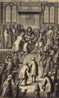 'The Royal Gift of Healing', King Charles II healing the sick, 1684. It was believed that the royal