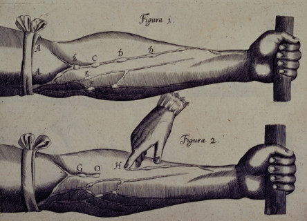Two arms, and a finger pointing towards a vein, 1628. Creator: Unknown.